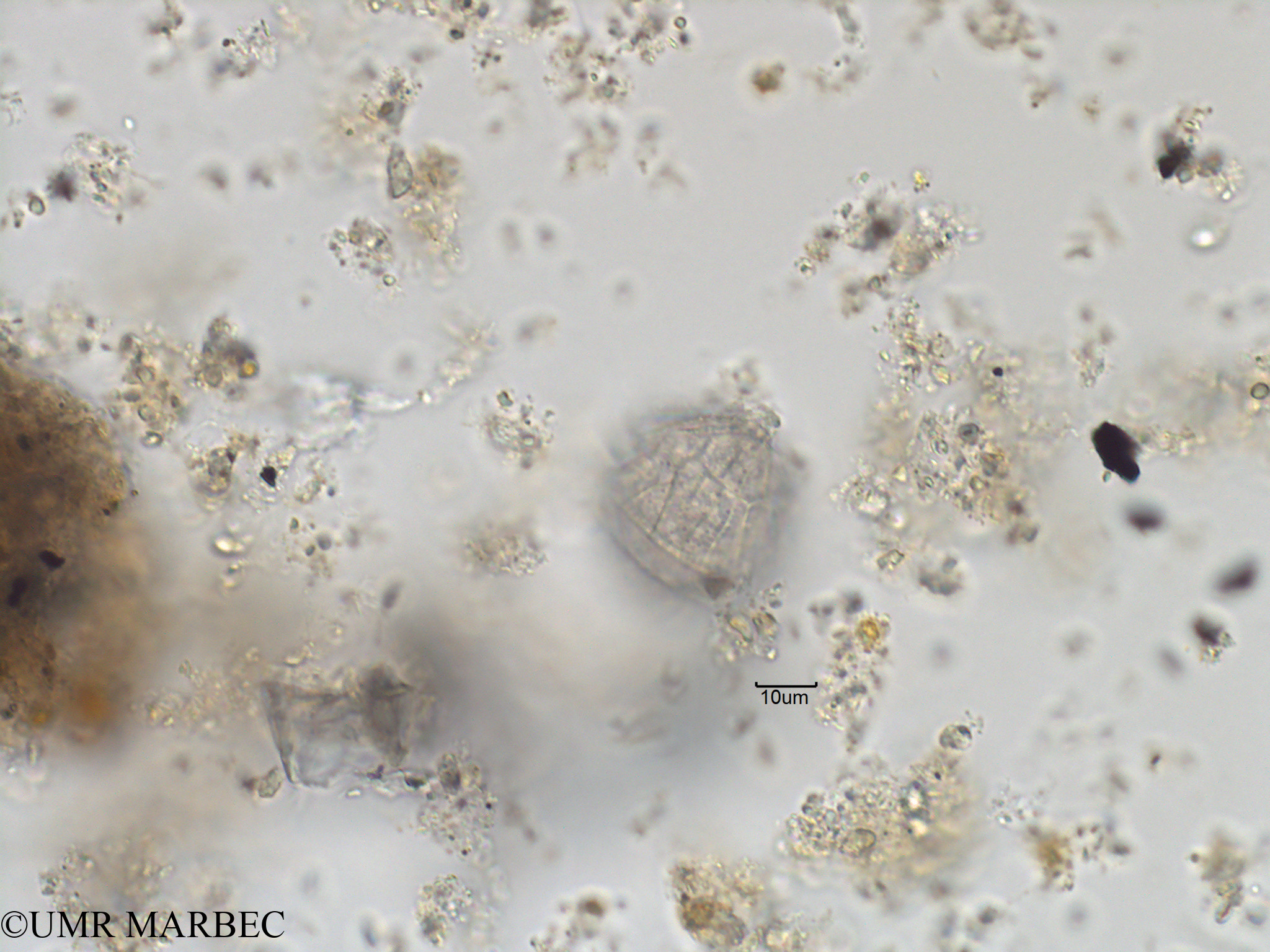 phyto/Bizerte/bizerte_bay/RISCO November 2015/Gonyaulax spinifera (Baie_T1C-Gonyaulax cf polygramma-3).tif(copy).jpg